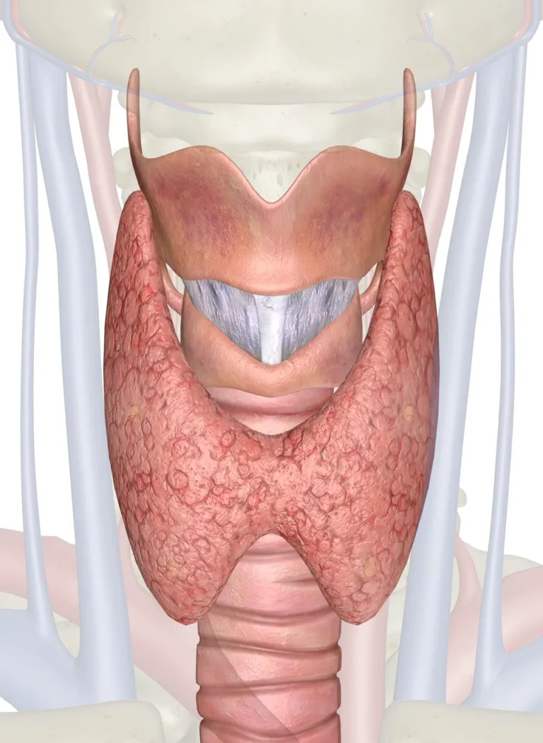 Schildklieroperatie (Thyroïdectomie)